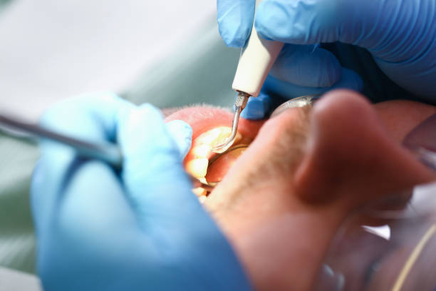 Best Tooth Pain Emergency Relief  in West Deland, FL
