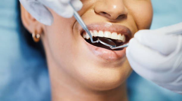 Best Teeth Whitening  in West Deland, FL
